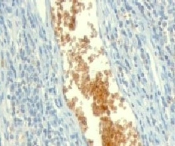 AMPD3 Antibody