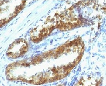 KLK3 Antibody