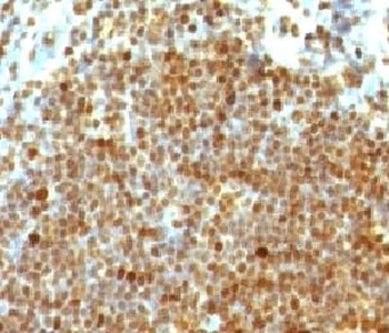 PCNA Antibody [PM441-1]