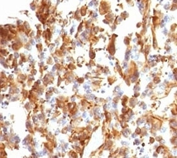 VIM Antibody