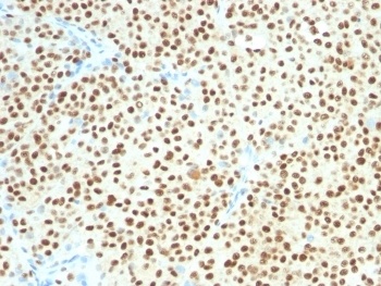 SOX10 Antibody [SOX10/1074]