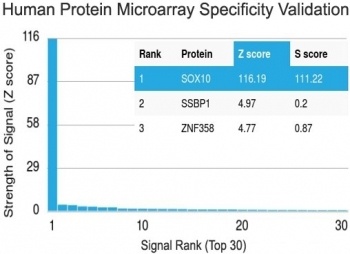 SOX10 Antibody [SOX10/991]