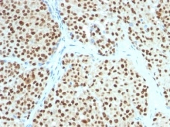 SOX10 Antibody [SOX10/991]