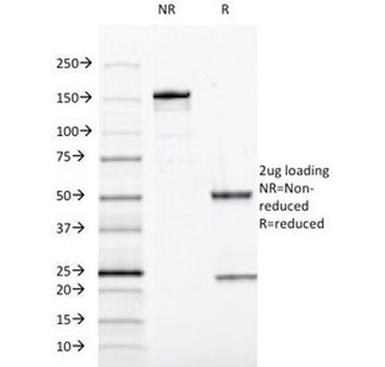 SOX10 Antibody [SOX10/991]