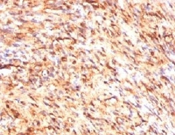 S100B Antibody