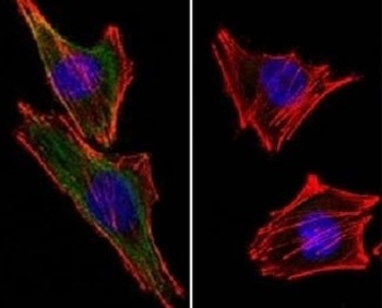 S100B Antibody