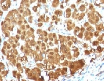 S100B Antibody [S100B/1012]