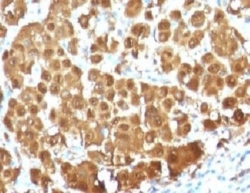 S100B Antibody