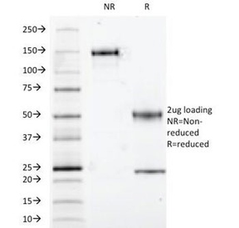 S100B Antibody [S100B/1012]