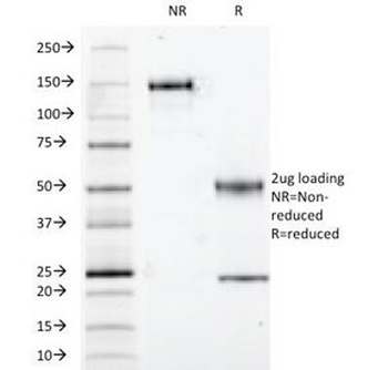 S100B Antibody