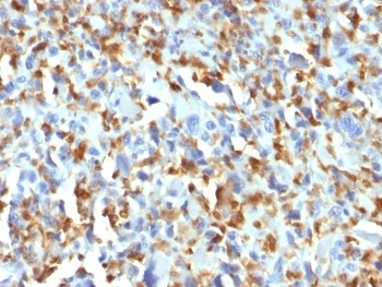 Coagulation factor XIII A chain Antibody [F13A1/1683]