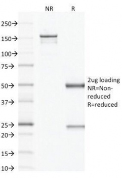 Coagulation factor XIII A chain Antibody [F13A1/1683]