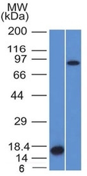 F13A1 Antibody