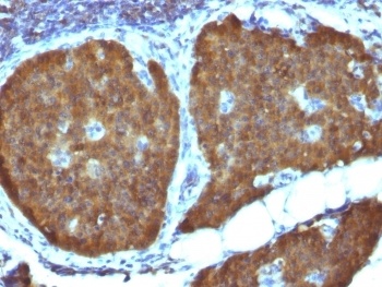 Neuron Specific Enolase Antibody [ENO2/1462]