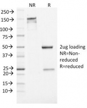 Neuron Specific Enolase Antibody [ENO2/1462]