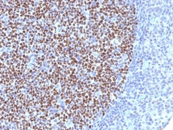 BCL6 Antibody