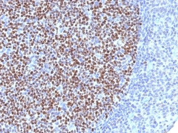 Bcl6 Antibody [BCL6/1527]