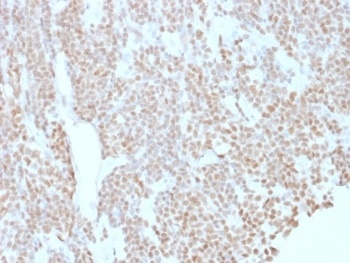 BCL6 Antibody