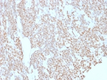 Bcl6 Antibody [BCL6/1527]