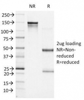 Bcl6 Antibody [BCL6/1527]