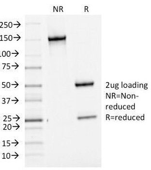 BCL6 Antibody