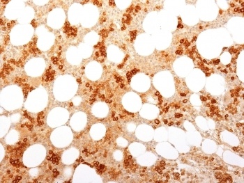 TFRC Antibody