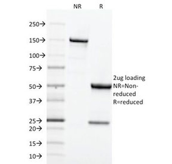 TFRC Antibody