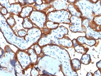 TFRC Antibody