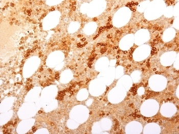 TFRC Antibody