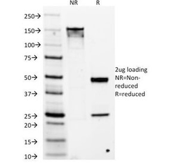 TMEM16A Antibody [DG1/1486]