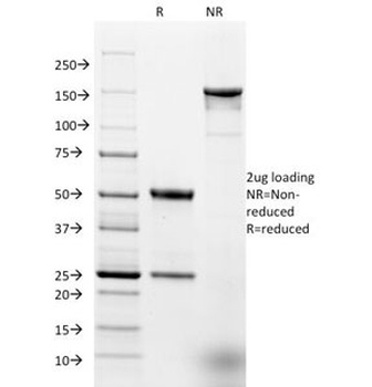 EPCAM Antibody