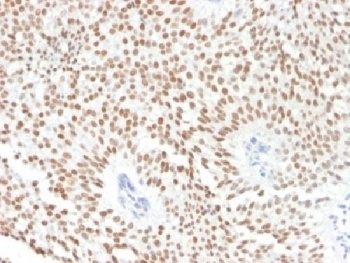FOXA1 Antibody [FOXA1/1241]