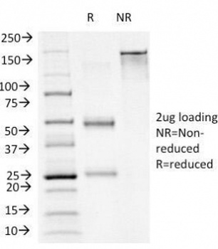 FOXA1 Antibody