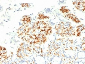 CD209 Antibody