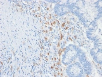 CD209 Antibody