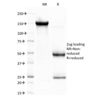 CELA3B Antibody [CELA3B/1757]