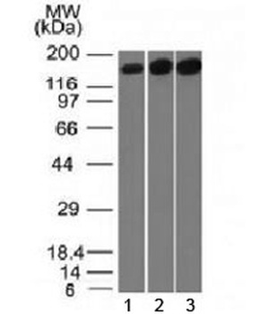 TOP2A Antibody