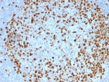 TOP2A Antibody