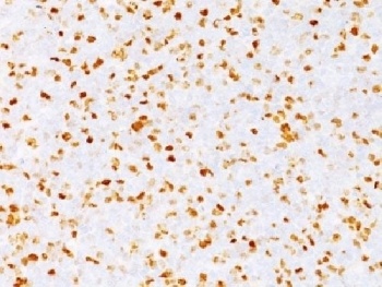 TOP2A Antibody