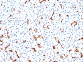 CFTR Antibody [CFTR/1785]