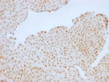 RB1 Antibody