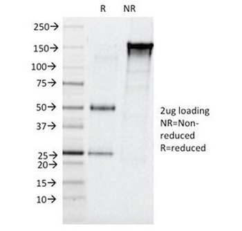 CELA3B Antibody [CELA3B/1257]