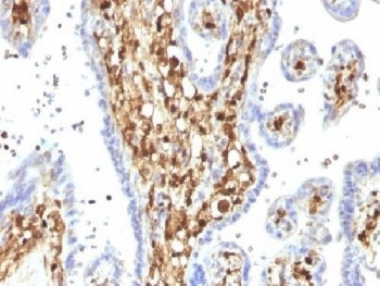 S100A4 Antibody