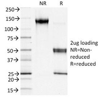 S100A4 Antibody [S100A4/1481]