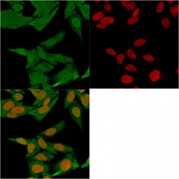 S100A4 Antibody