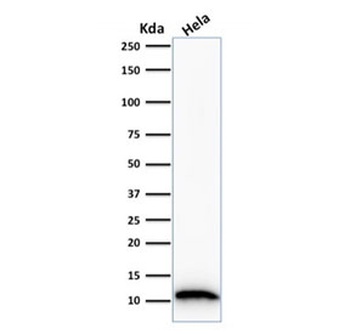 S100A4 Antibody [S100A4/1481]