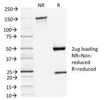 TSHR alpha chain Antibody [TSHRA/1402]