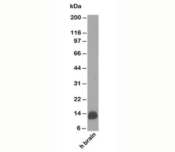 S100B Antibody
