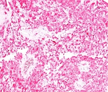 S100B Antibody [4C4.9]