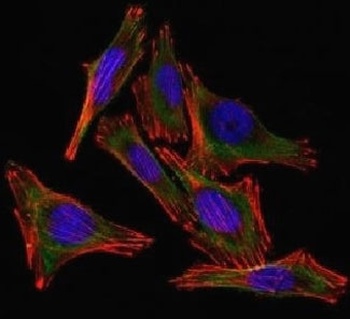 S100B Antibody